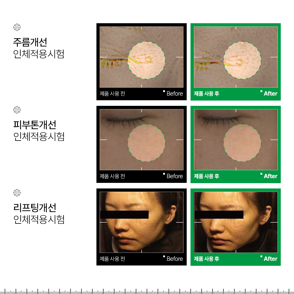 피부과 레이저 재생관리 점뺀후 여드름 인포디플러스 엑세스피316 리페어 재생 크림 50ml, 1개 - 상세 이미지 2
