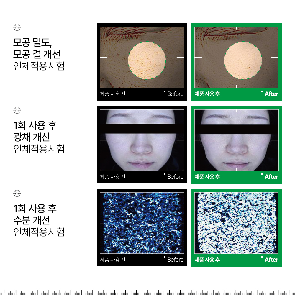 모공 화이트헤드 블랙헤드 쿨패드 인포디플러스 엑세스피316 하이드로비타 겔 패드 70매, 1개 - 상세 이미지 2