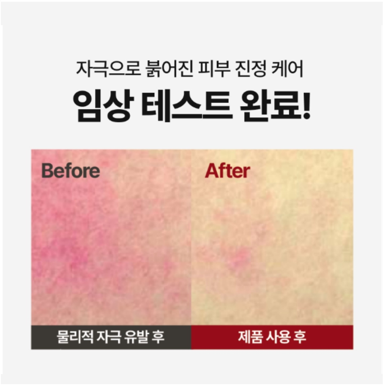 세라마이드 판테놀 재생 리페어 크림 장벽 보습 엑소리쥬 세라콜지 242 이미지 4