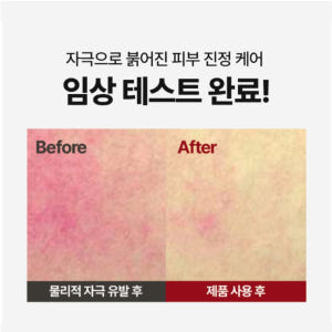 세라마이드 판테놀 재생 리페어 크림 장벽 보습 엑소리쥬 세라콜지 242 솔직 후기 | 피부 타입별 분석 - 상품 이미지 4