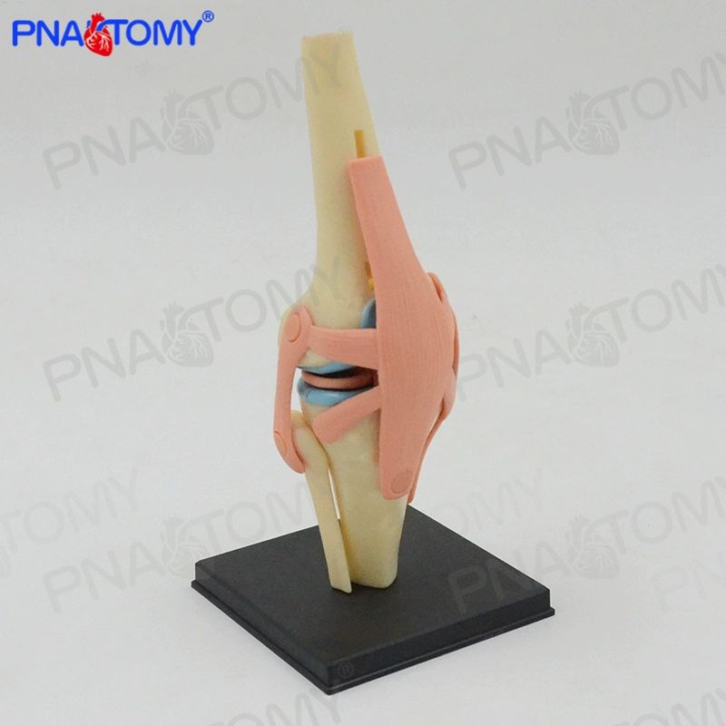 무릎 관절 모형 인체 병원 해부 골격 교육용 인대 정형외과 뼈대 무릎관절모형 부분치환술 - 상세 이미지 3