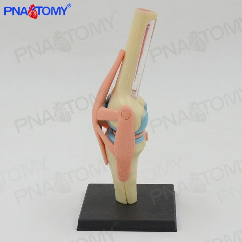 무릎 관절 모형 인체 병원 해부 골격 교육용 인대 정형외과 뼈대 무릎관절모형 부분치환술 - 상세 이미지 2