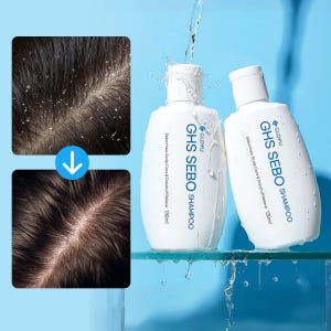 [리뷰 약속 1+1] GHS 세보 샴푸 [지루성 두피 모낭염 지성두피 청... 솔직 후기 | 피부 타입별 분석 - 상품 이미지 1