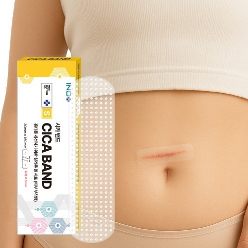 메디섹션넘버S 시카케어 켈로이드 제왕절개 흉터 상처 화상 시카 밴드 1개입 (3cm x 15cm 0.5T) - 상품 이미지
