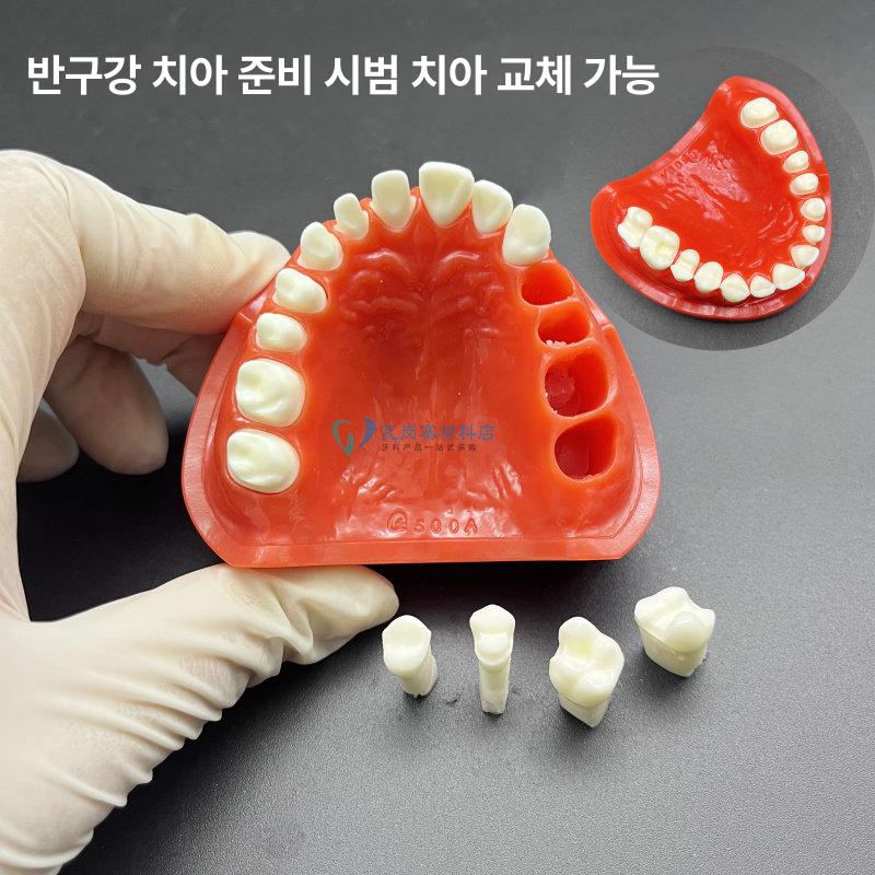 치석 치과 모형 상담 자료 치아 치주 덴티폼 착색 단일 항목 - 상세 이미지 2
