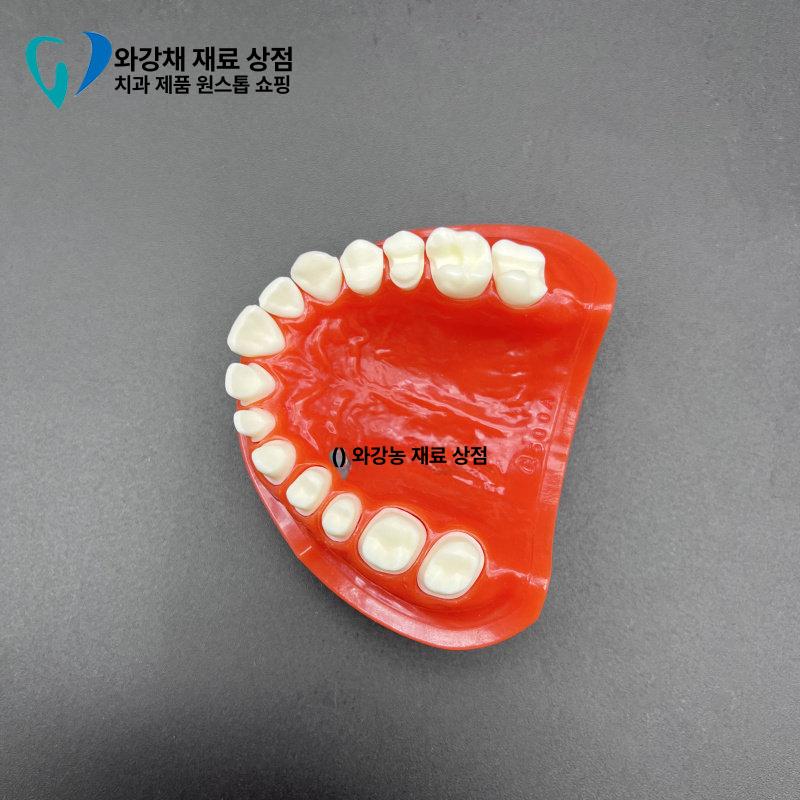치석 치과 모형 상담 자료 치아 치주 덴티폼 착색 단일 항목 - 상세 이미지 3
