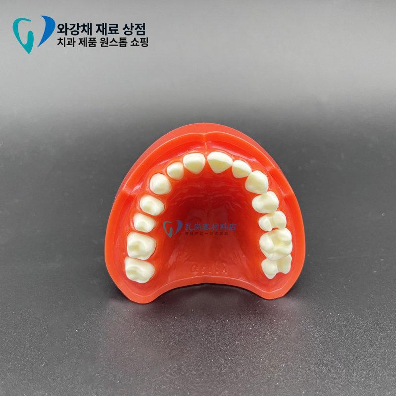 치석 치과 모형 상담 자료 치아 치주 덴티폼 착색 단일 항목 - 상세 이미지 4