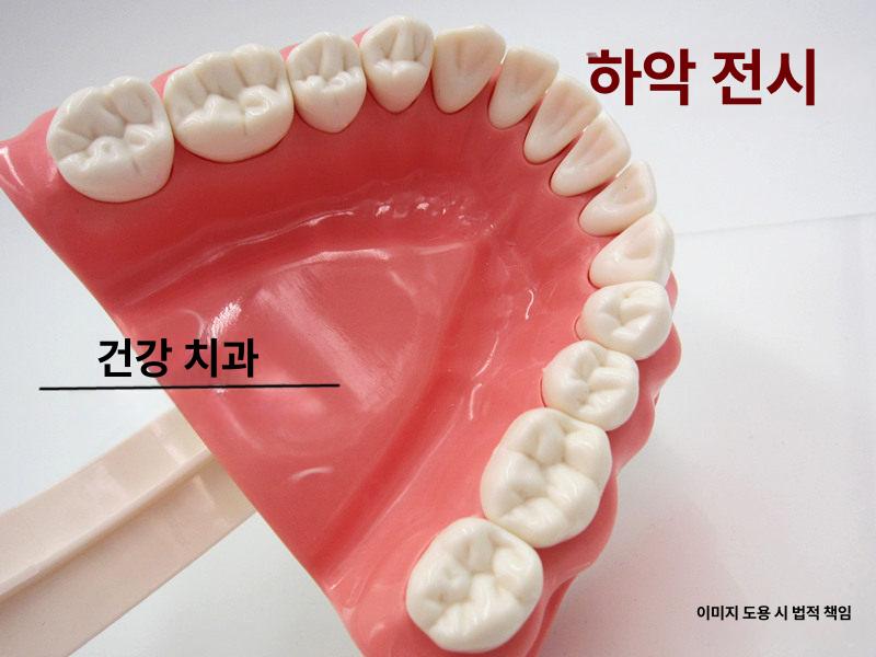치아모형 구강 디스플레이 실습 교구 병원 이빨모형 교육 1 1 소형 모델 - 상세 이미지 5