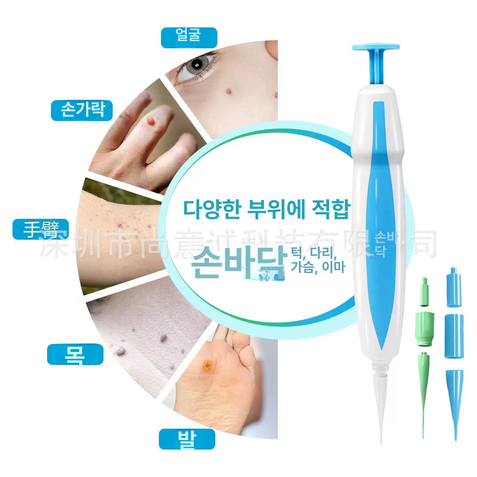 쥐젖 제거 키트 제거기 홈케어 점제거 기미잡티 미용 - 상세 이미지 4