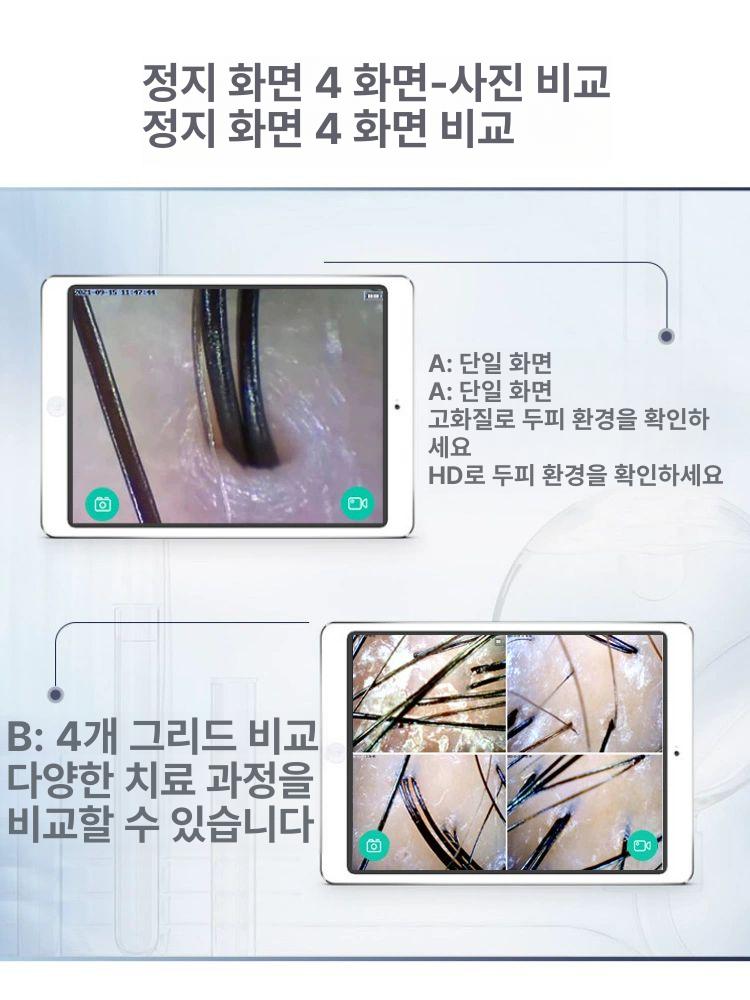휴대용 무선 두피 모발 분석기 진단기 탈복 측정기 M-906S-200 200배 - 상세 이미지 3