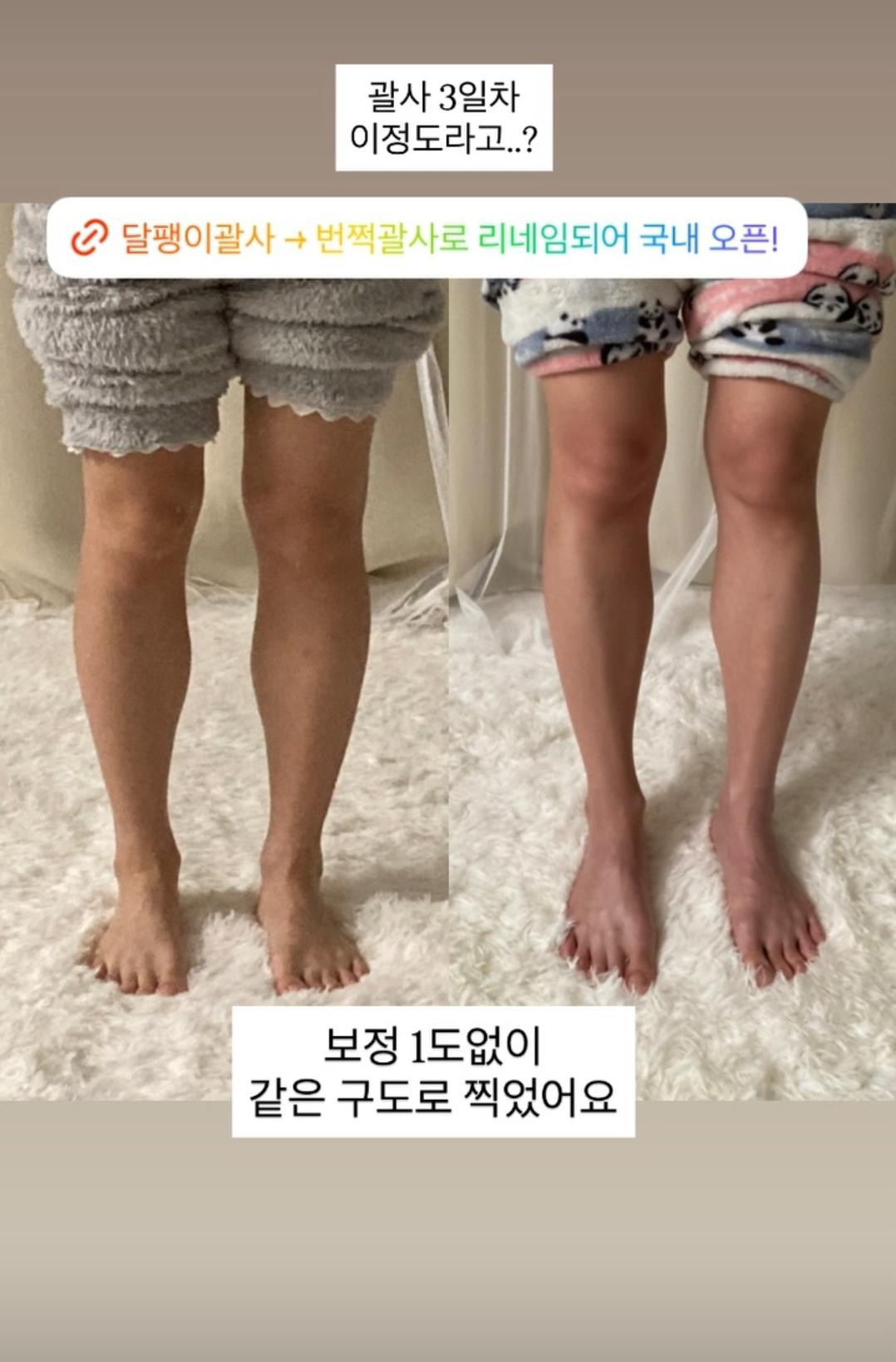 [번쩍괄사] 에너지파 천연밀랍 마사지기 얼굴 붓기 두피 관리 부종 블랙 - 상세 이미지 3