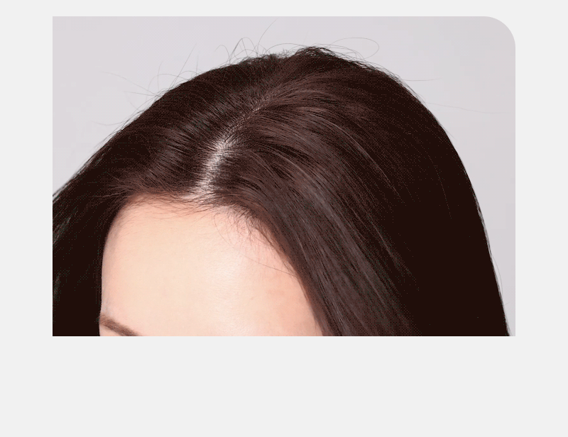 RYO Root:Gen Root Volumizer - description 11