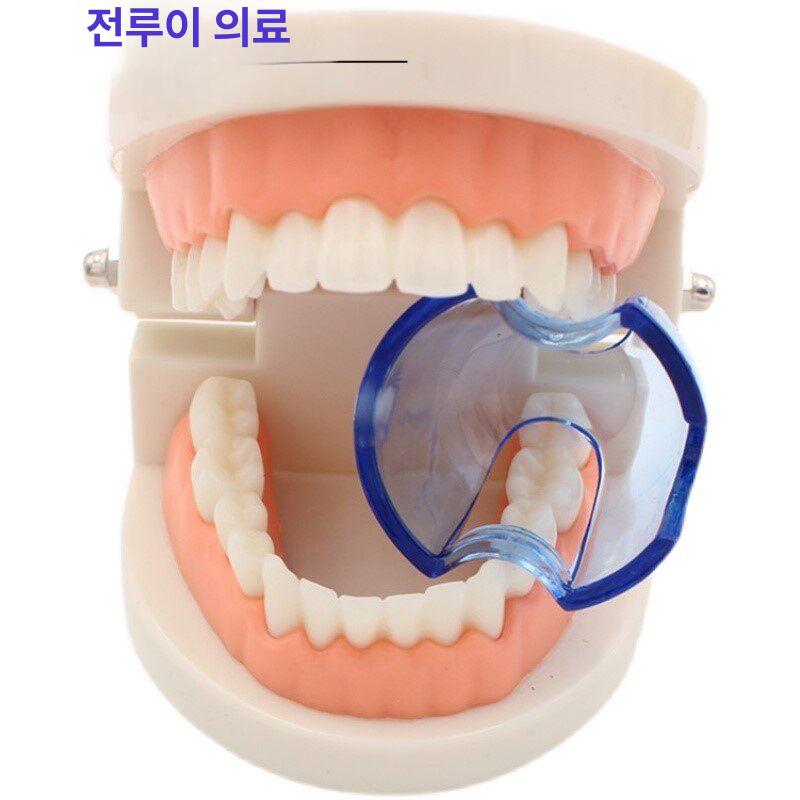 개구기 치과용 오프너 어금니 뒷니용 턱 열기 파란색 입 후면 블루 개구기 1개 - 상세 이미지 5