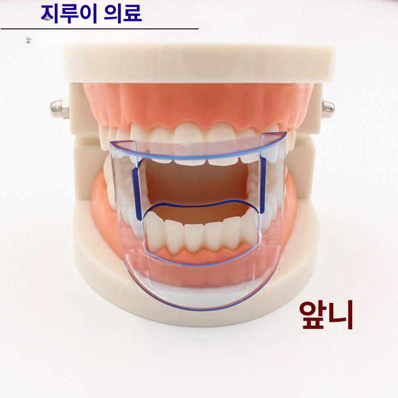 개구기 치과용 오프너 어금니 뒷니용 턱 열기 파란색 입 후면 블루 개구기 1개 - 상세 이미지 2