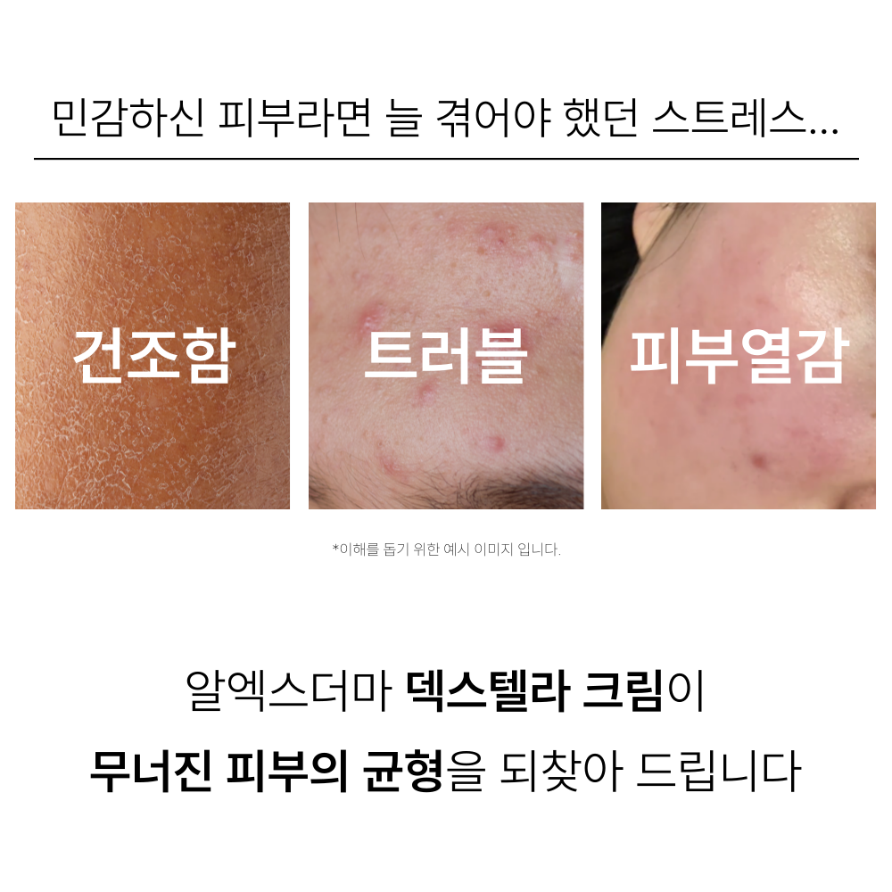 디판테놀 크림 피부과 여드름 재생관리후 진정 요철 덱스판테놀 살리실산 흔적 시카 100ml 이미지 7