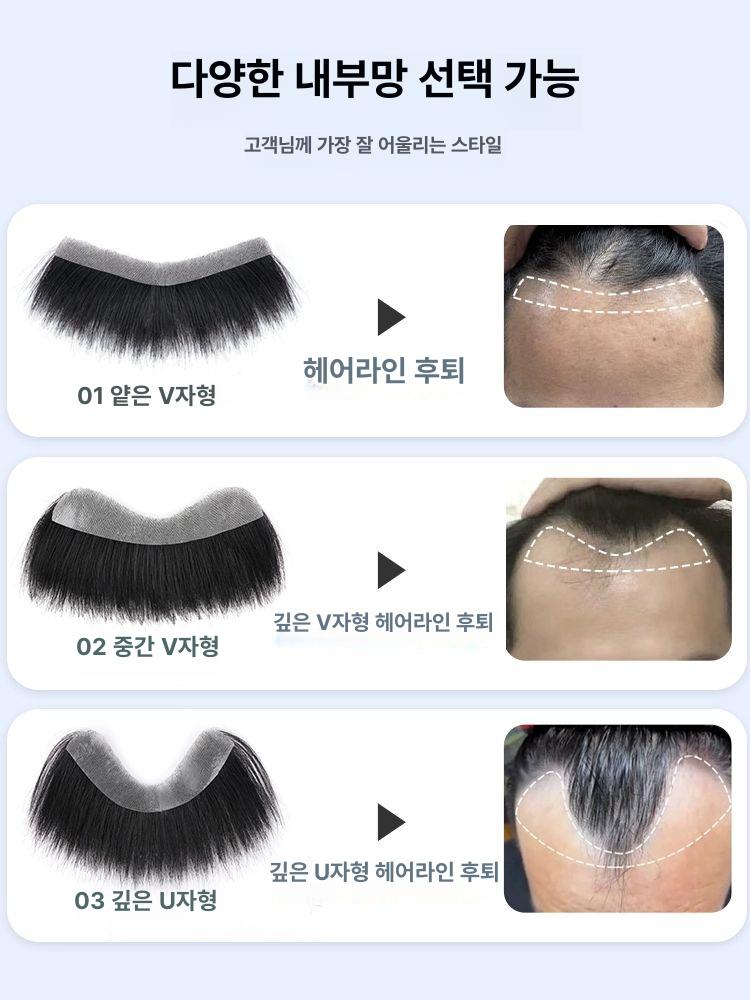 접착 가발 남성용 스킨 앞머리 넓은이마 커버 부분 붙임머리 탈모 - 상세 이미지 3