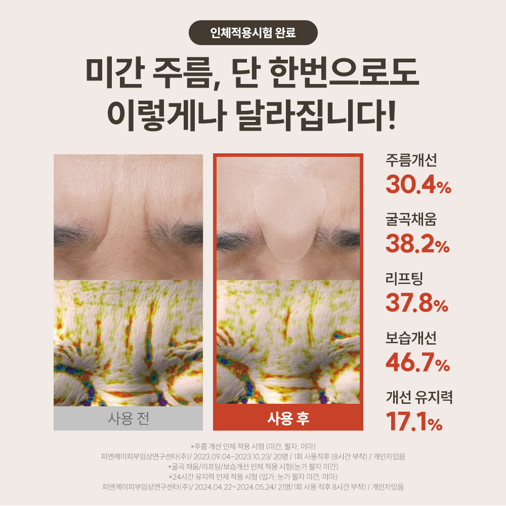미간 주름 주름 관리법 링클 리페어 패치 주름 패치 추천 미간 주름 개선