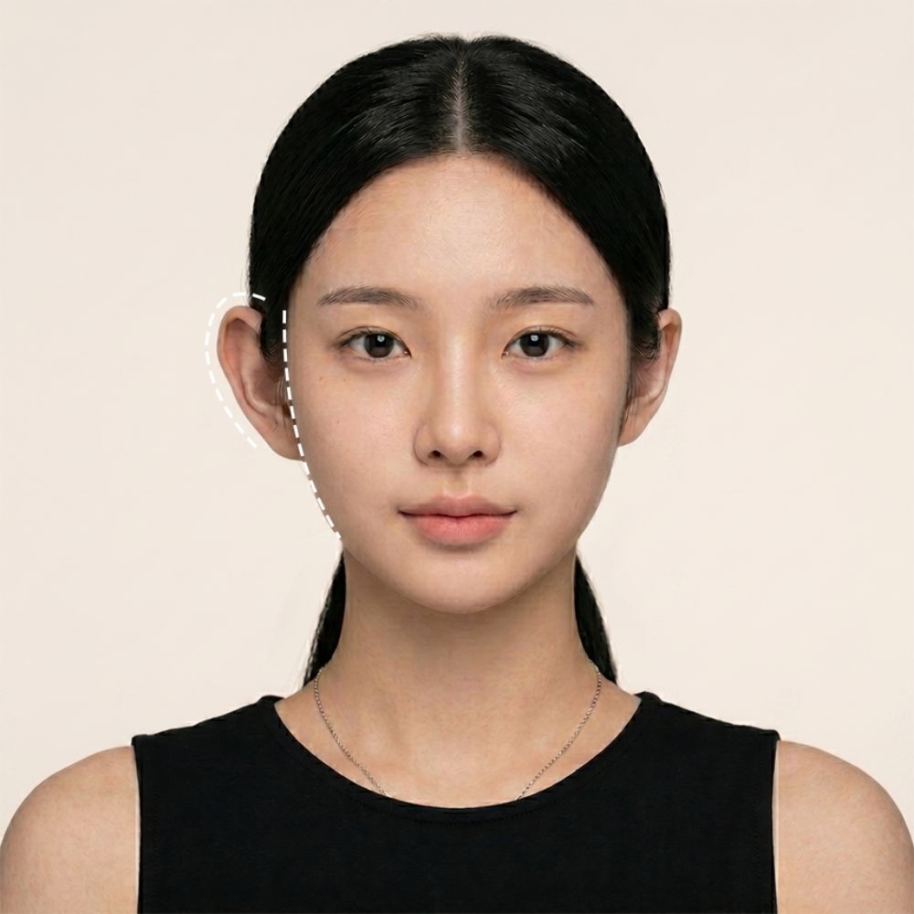 누운귀테이프 60P 요정귀테이프 스티커 귀세우는 패치 엘프귀 접힌귀 귀또렷 교정 이미지 2