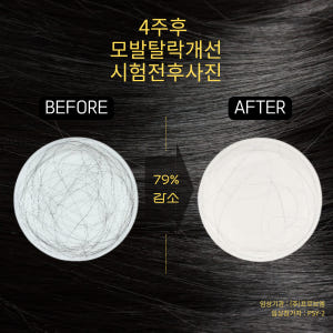 라비엘르 리바이브 테라피  탈모샴푸 비듬 가려움 완화 약산성 녹차 저자극 솔직 후기 | 피부 타입별 분석 - 상품 이미지 4
