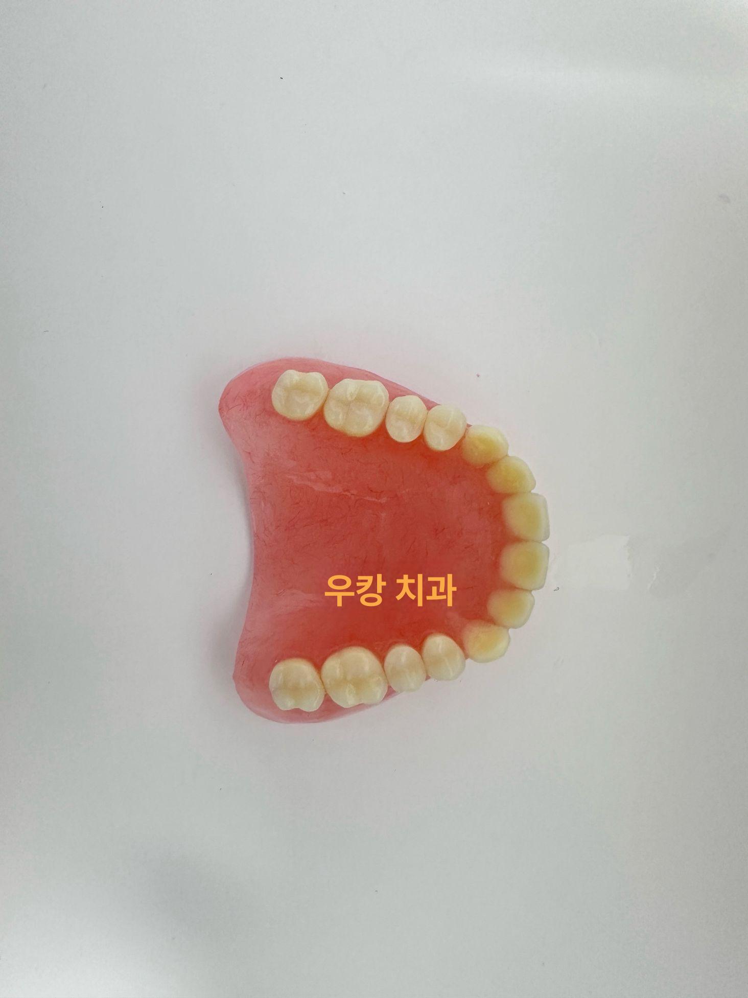 치석 치과 모형 착색 덴티폼 치아 자료 치주 상담 - 상세 이미지 5