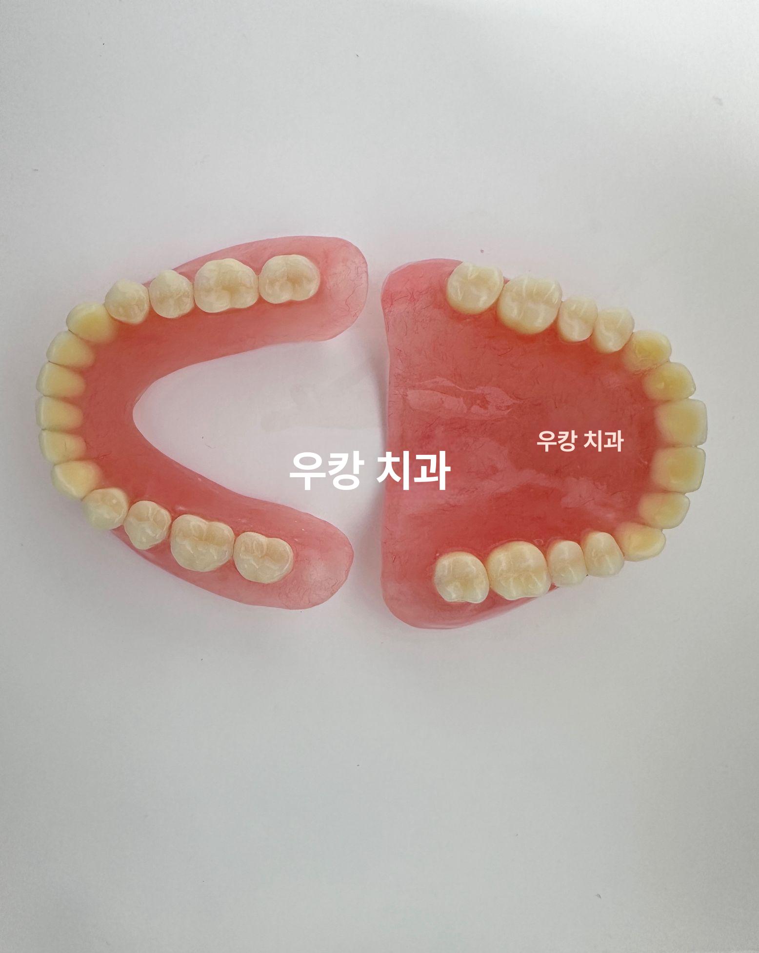 치석 치과 모형 착색 덴티폼 치아 자료 치주 상담 - 상세 이미지 4