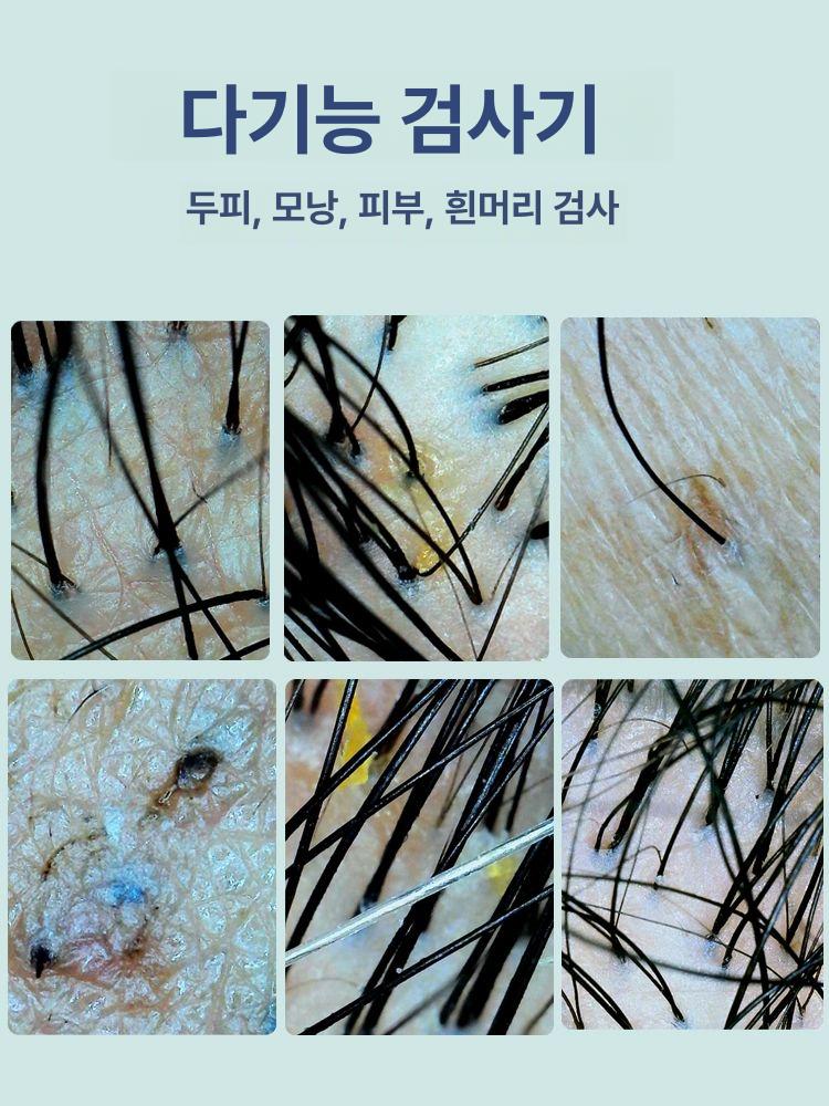 광학 두피진단기 디지털 확대경 두피카메라 헤어 두피스케일링 분석기 검사 자체 디지털확대경 - 상세 이미지 4