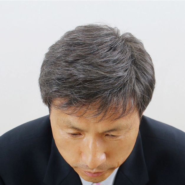 인모 가발 숏컷 남성 자연스러운 클립 중년 내추럴 남성용 남자 짧은 자 정수리 머리 - 상세 이미지 2