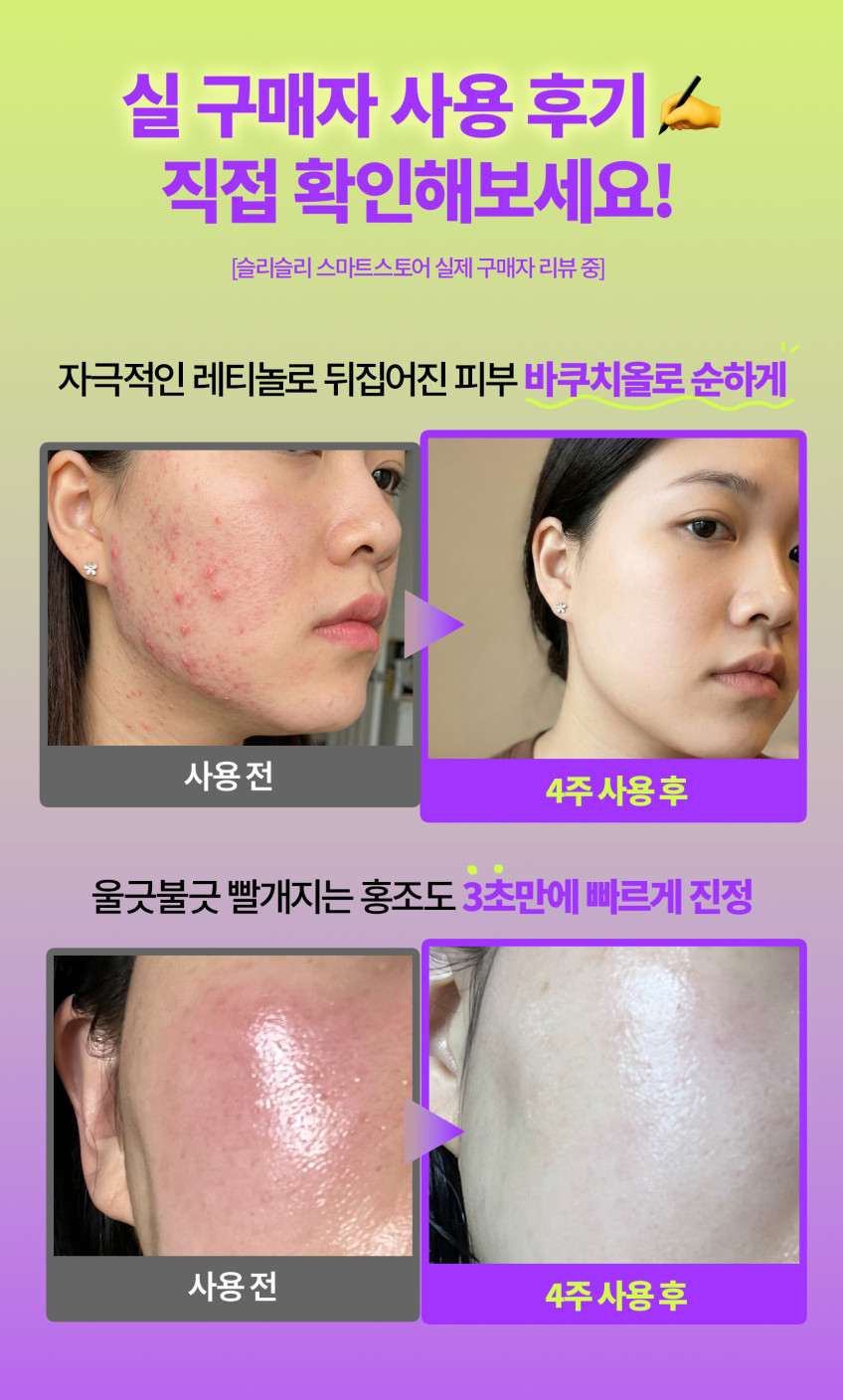 슬리슬리 PDRN 피디알엔 바쿠치올 히알루론산 모공 쫀쫀 세럼 30ml, 2개 판매처 상세 정보 이미지 3