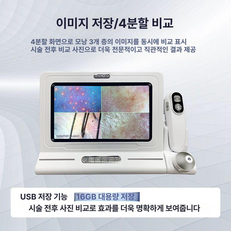 두피측정기 모발 탈모 두피 분석기 확대경 진단기 헤어진단솔루션 모공 모델 분석 카메라 - 상세 이미지 4