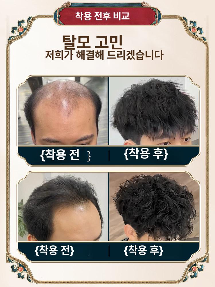 가발 멋내기 남자가발 똑딱이 정수리커버용 - 상세 이미지 5