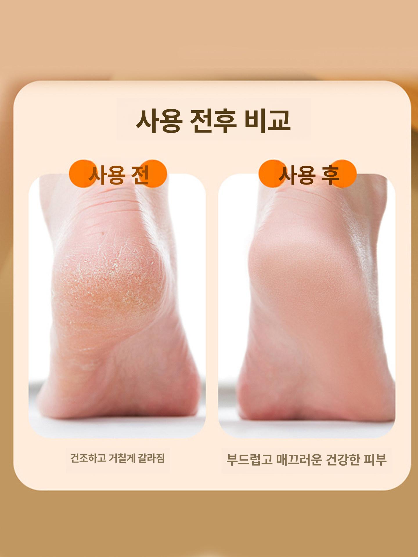 뒷꿈치 발 각질제거기 전동기 페티규어 굳은살 없애기 기계 - 상세 이미지 3