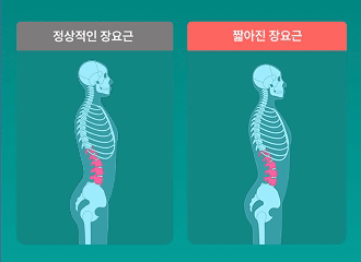 닥터장요힐 장요근마사지기 바디괄사 장요근 마사지 림프순환 판매처 상세 정보 이미지 4