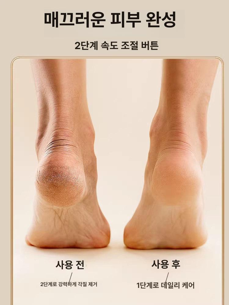 전동 굳은살 뒤꿈치 발뒤꿈치 각질제거기 신형 골든옐로우 3개 연마 헤드 이미지 6