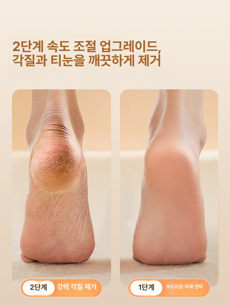 전기 발 각질 제거기 죽은 피부 연마기 발뒤꿈치 관리 최상위 모델 거칠기 중간 미세 3개 헤드 A - 상세 이미지 3