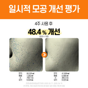 PDRN 앰플 고함량 피디알엔 바이옴 69% 히알루론산 모공 스킨부스터 ... 솔직 후기 | 피부 타입별 분석 - 상품 이미지 2