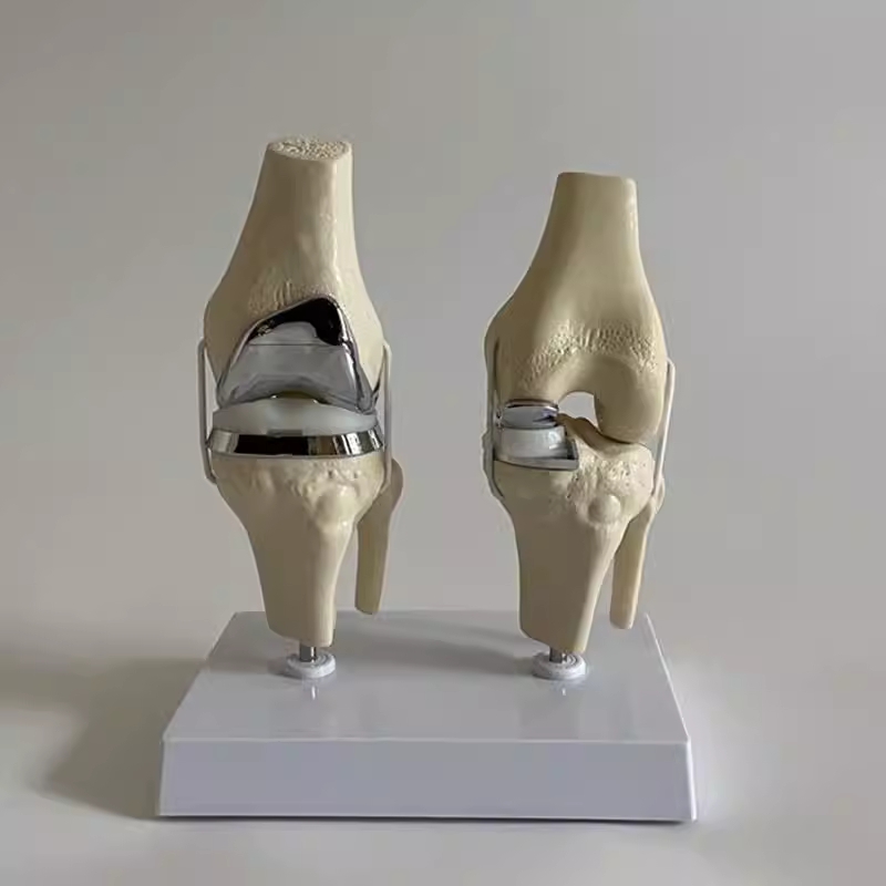 무릎관절 모형 인공 기능성 허리 근육 뼈모형 교구 전체 치환 - 상세 이미지 2