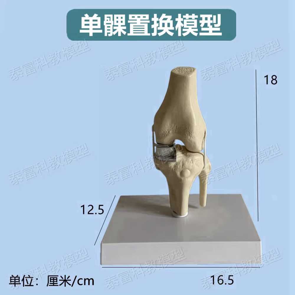 무릎관절 모형 부분치환술 실습 교육 병원 인체모형 부분 이미지 6