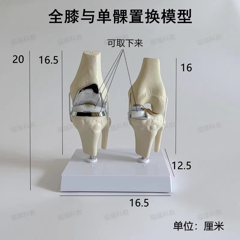 무릎관절 모형 인공 기능성 허리 근육 뼈모형 교구 전체 치환 - 상세 이미지 3