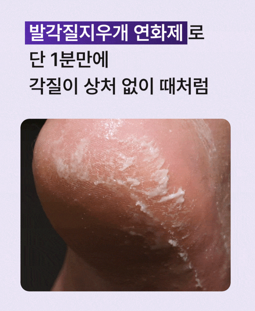 바렌 패디퍼펙트 전동 발각질 제거기 퍼플에디션 발 뒤꿈치 발바닥 굳은살 퍼플 판매처 상세 정보 이미지 4