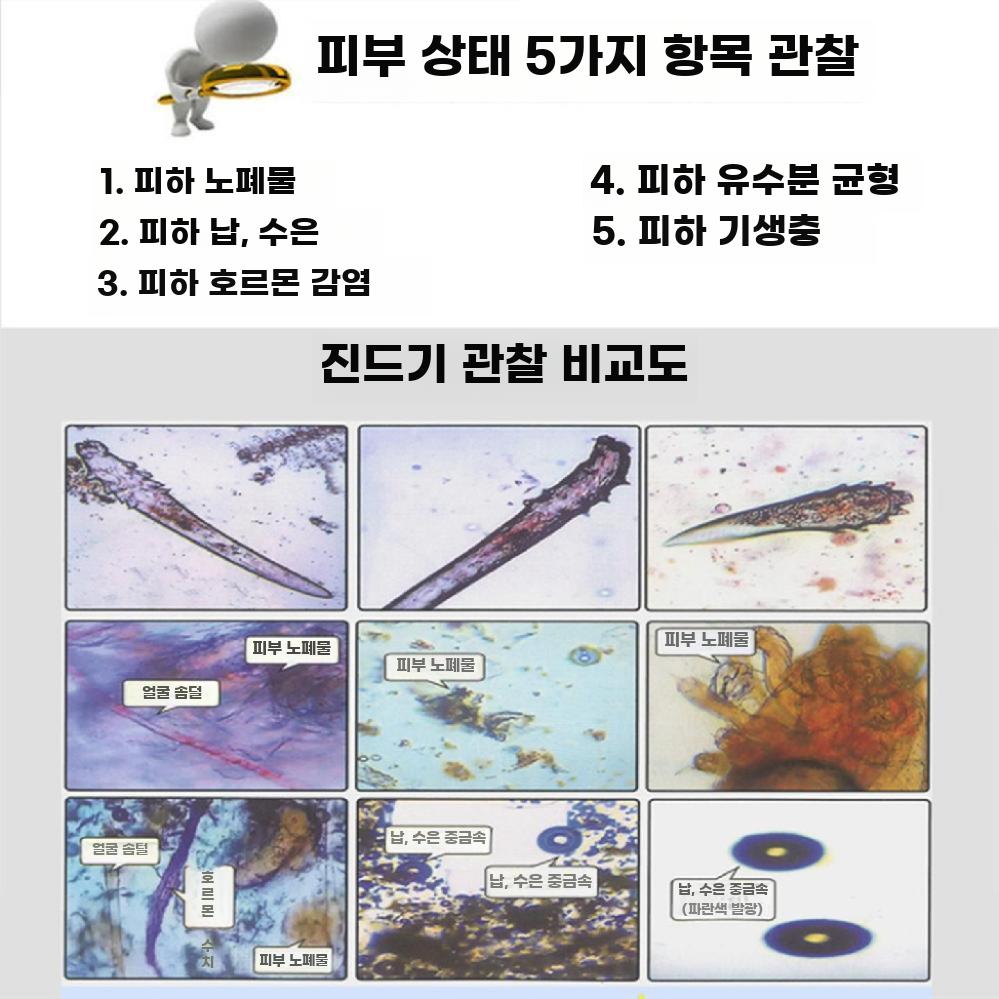 모니터 일체형 현미경 디지털 전자 확대경 진드기 고배율 진드기+7인치 화면+알루미늄 박스 - 상세 이미지 4