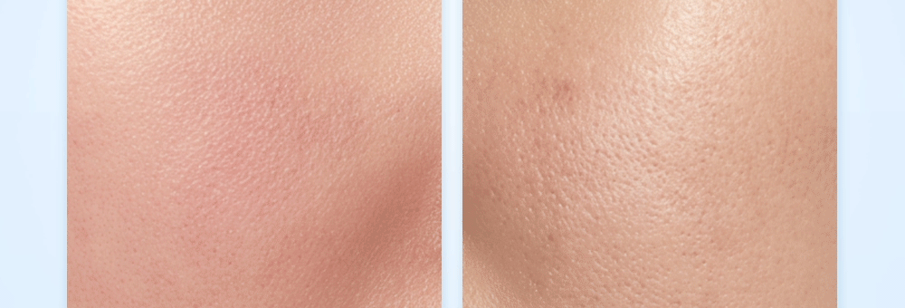 cellfusionc WaterFit™ hydro complex tone-up cream