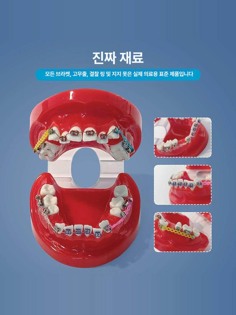 교정 치아모형 구강 연습용 치과 실습 교육용 치위생사 덴탈 스터디 학습 연구 - 상세 이미지 4