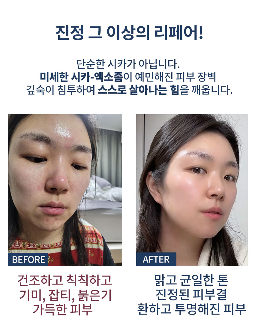 펄리 모공 탄력 히알루론산 미백 시카 엑소좀 재생 앰플 50ml, 1개 이미지 2