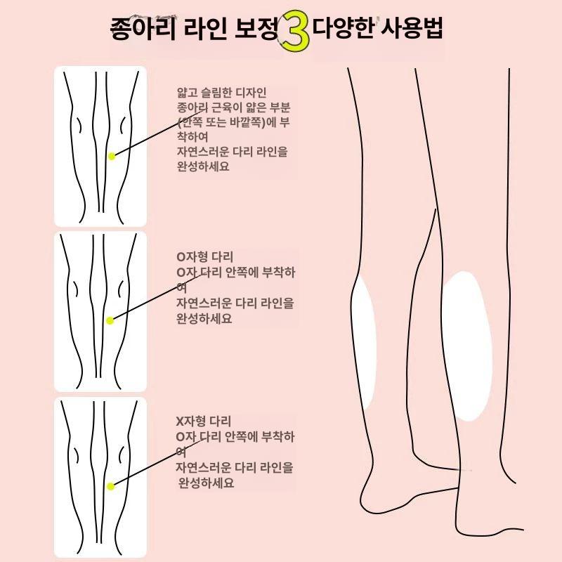 O자 종아리 다리 실리콘 패드 보정 일자다리 스티커 오다리 - 상세 이미지 4