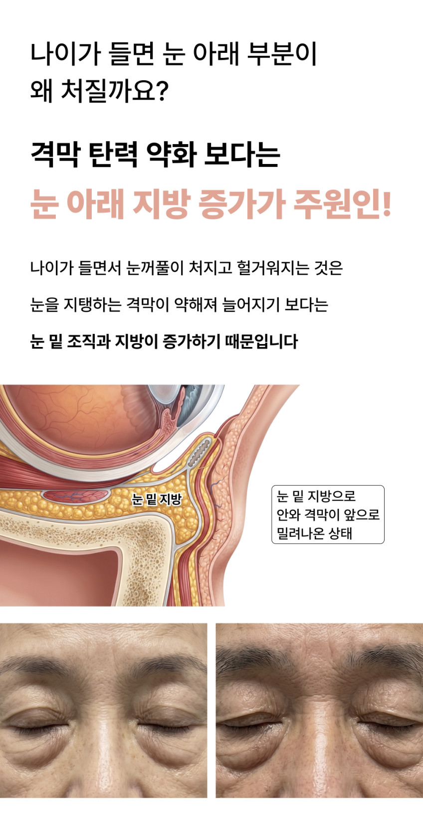 펄케어 고주파 눈밑 눈가 얼굴 마사지기 뷰티 디바이스 홈케어 판매처 상세 정보 이미지 3