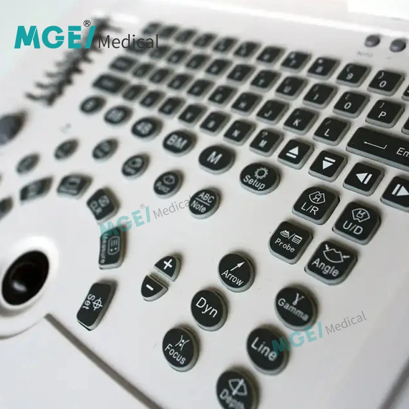UMWD58 MEDIGE 휴대노트북 컬러 도플러 초음파 스캐너 기계 선명이미지