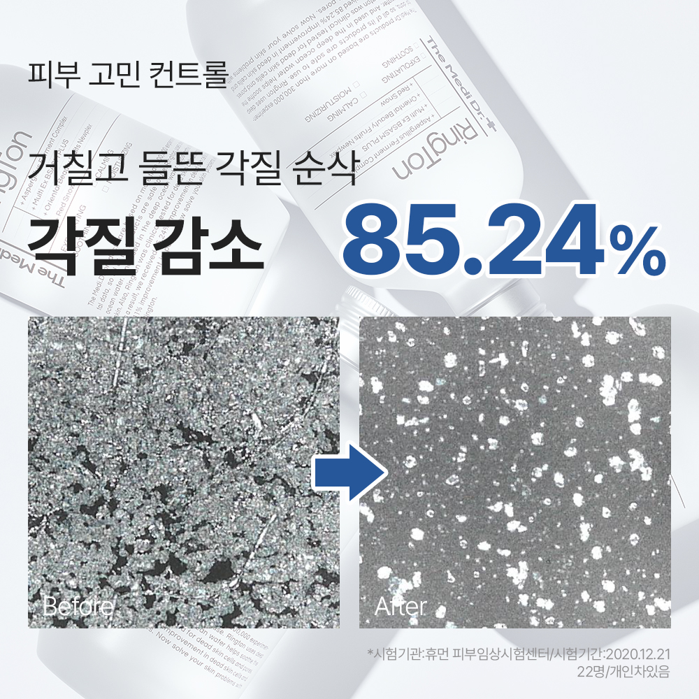 미스트 공병 1개 증정 /  링톤 토너 300ml, 1개 이미지 4
