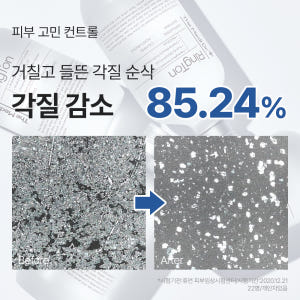 미스트 공병 1개 증정 /  링톤 토너 300ml, 1개 솔직 후기 | 피부 타입별 분석 - 상품 이미지 4