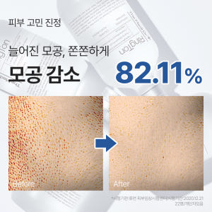 미스트 공병 1개 증정 /  링톤 토너 300ml, 1개 솔직 후기 | 피부 타입별 분석 - 상품 이미지 3
