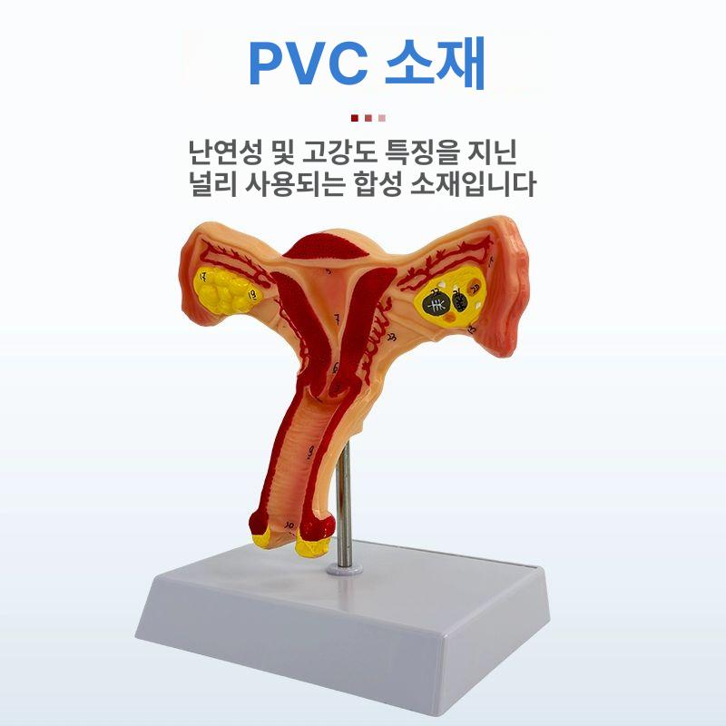 해부학 자궁모형 산부인과 모델 골반 생식기 실습 인체 교육용 난소자궁 - 상세 이미지 5